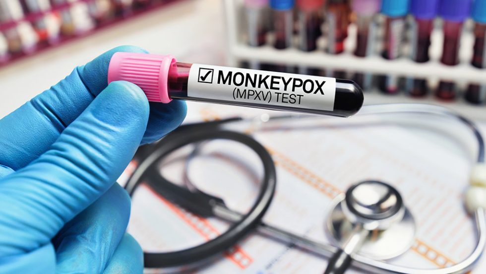 mpox